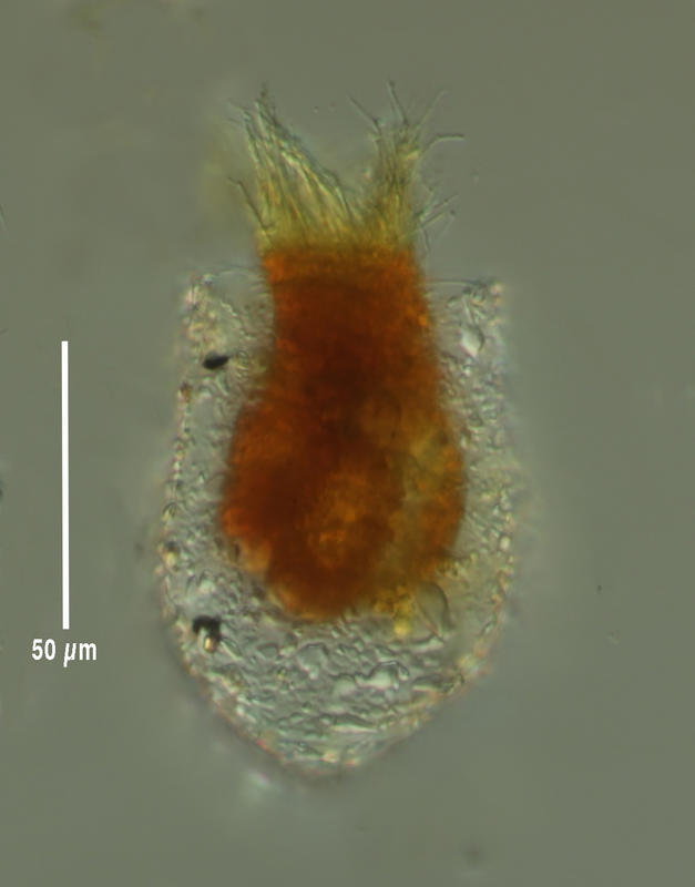 Tintinnopsis saculus