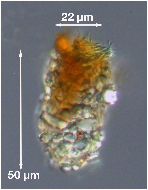 Tintinnopsis acuminata