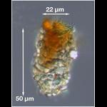 Tintinnopsis acuminata