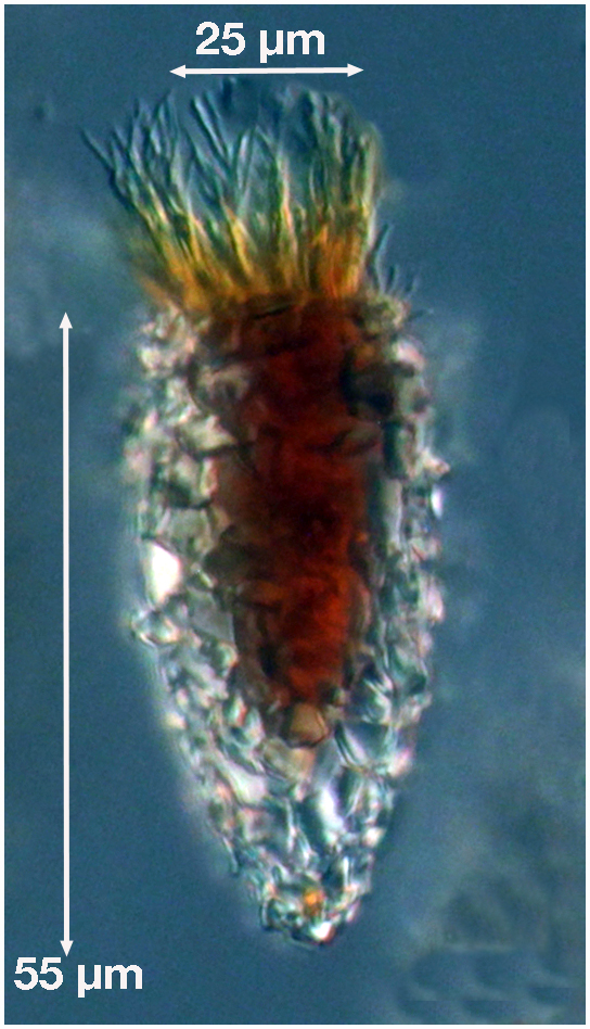 Tintinnopsis rapa