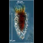 Tintinnopsis rapa