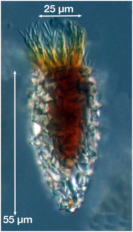 Tintinnopsis rapa