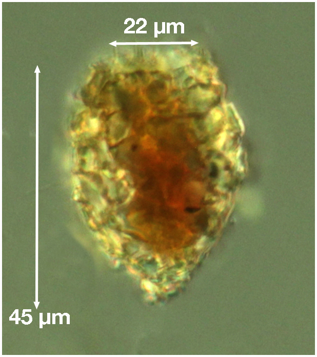 Tintinnopsis parva