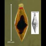 Fusopsis polyhedra presumptive ciliate cyst