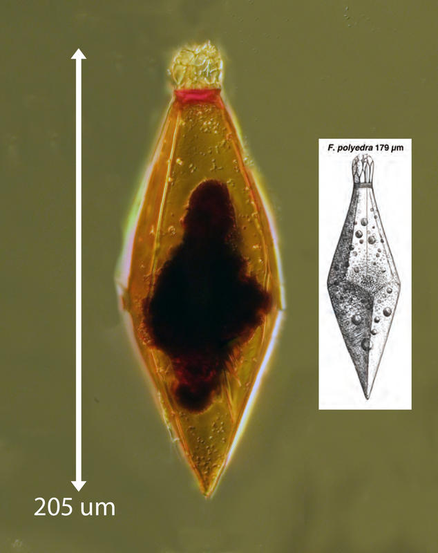 Fusopsis polyhedra presumptive ciliate cyst