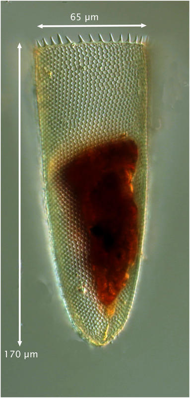 Parafavella hadai