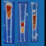 Parasitised tintinnid