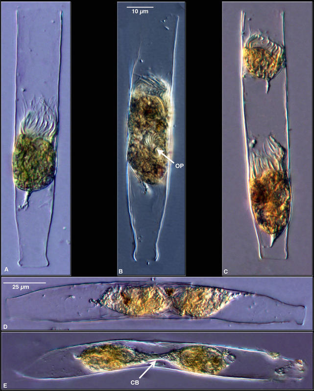 Life history stages of a tintinnid, Eutintinnus inquilinus