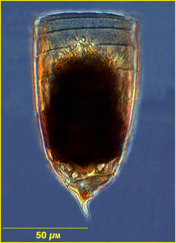 Coxliella laciniosa