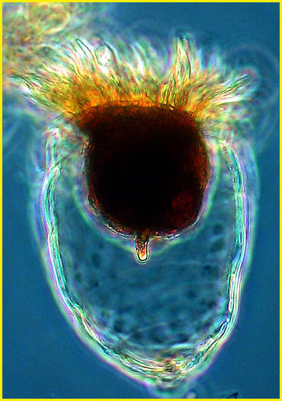 Coxliella ampla