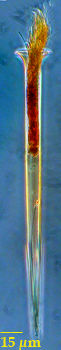 Salpingella acuminata