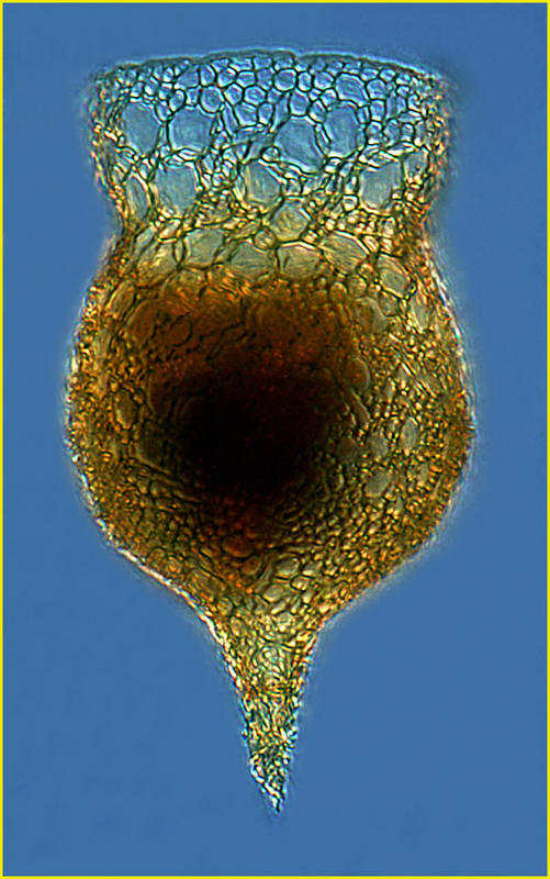 Codonella amphorella