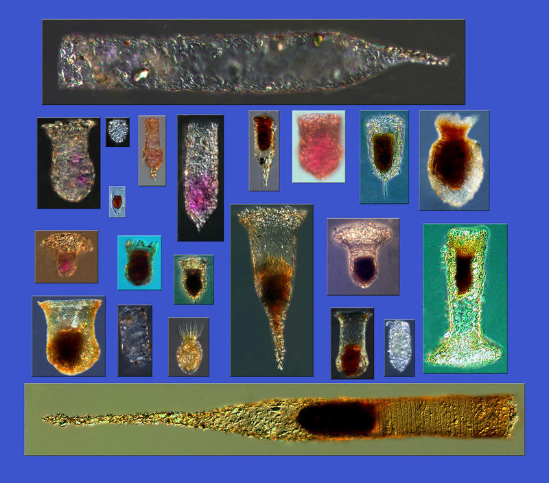 Tintinnopsis species