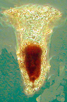 Tintinnopsis butschlii