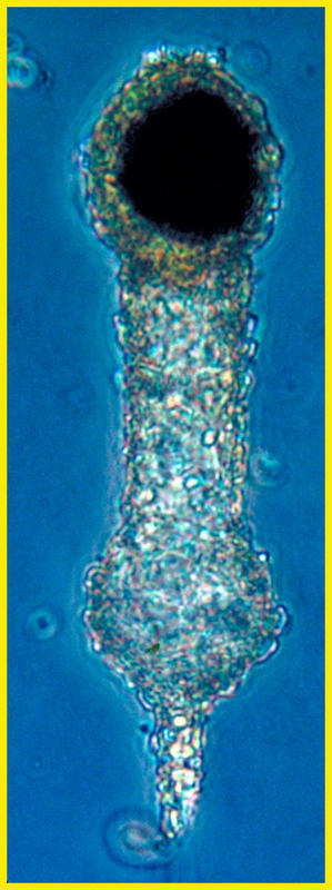 Tintinnopsis tocantinsis cyst