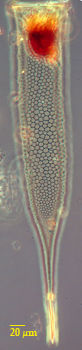 Xystonella lohmanni
