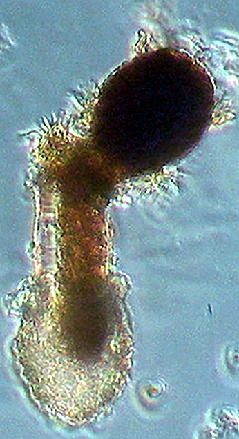Codonellopsis morchella attacked