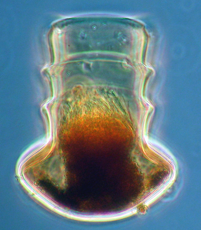 Amplectella collaria
