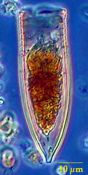 Helicostomella edentata