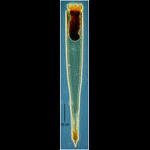Xystonellopsis armata
