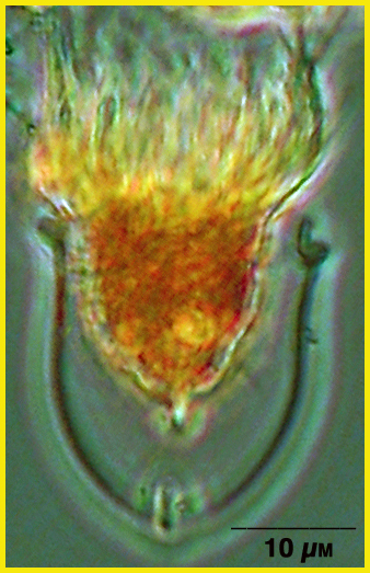 Ascampbelliella armilla