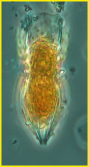 Amphorellopsis sp?