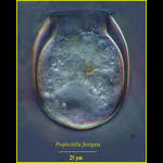 Proplectella fastigata