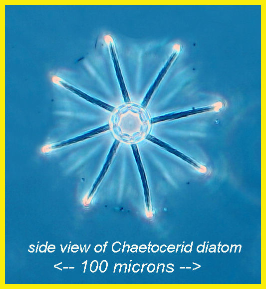 Chaetocerid diatom