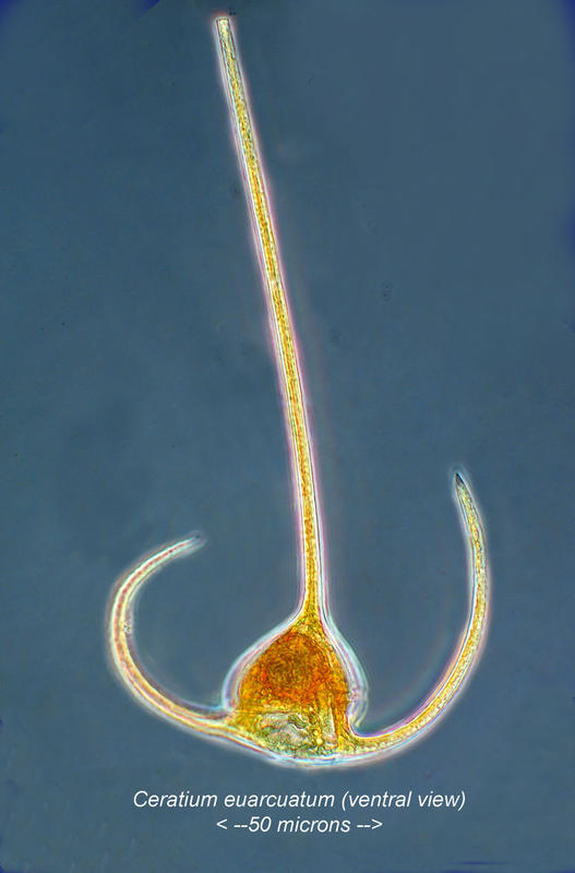 Ceratium arietinum mis-labeled...!