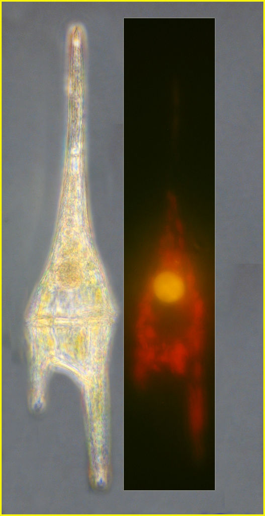 Mixotrophy in Ceratium furca