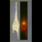 Mixotrophy in Ceratium furca