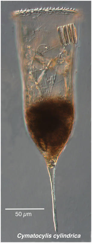 Cymatocylis cylindrica