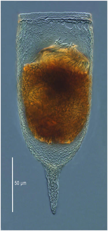 Favella ehrenbergii