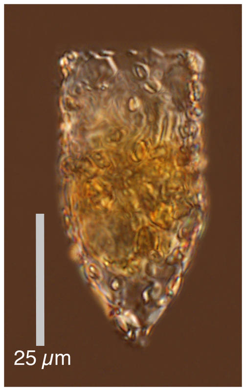 Tintinnopsis nana/minuta