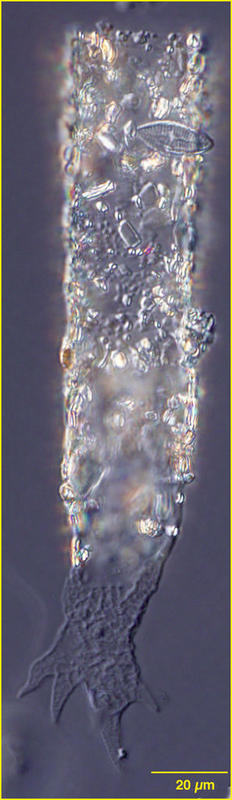 Tintinnopsis corniger or Rhizodomus tagatzi