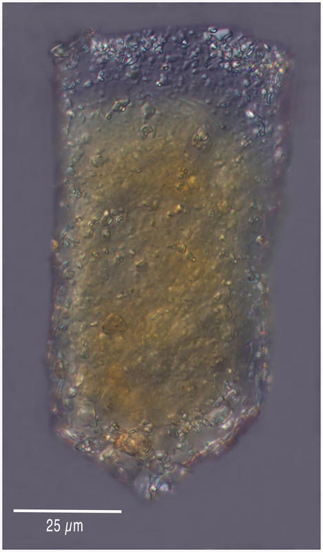 Tintinnopsis lindeni (probably)