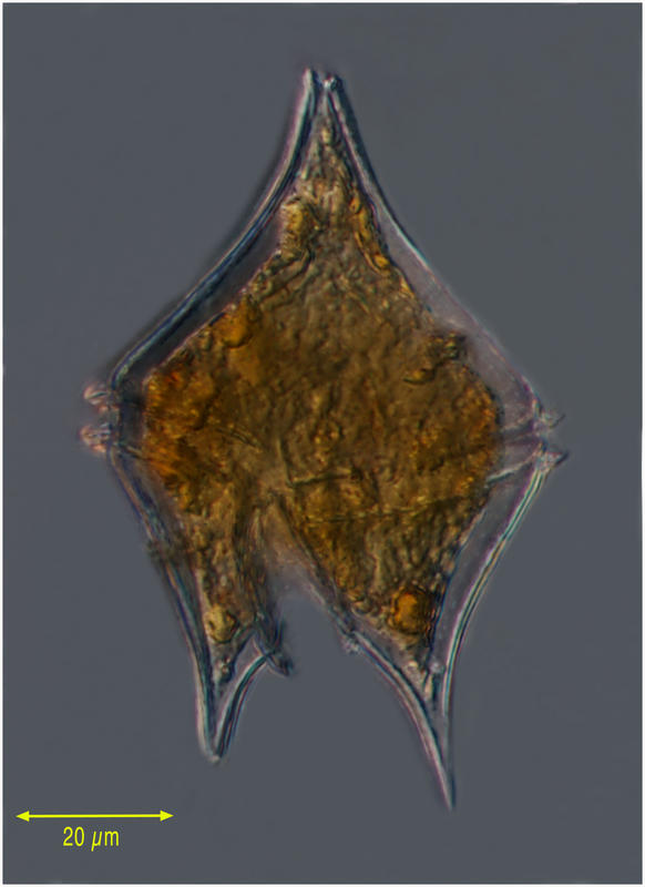 Protoperidinium oblongum