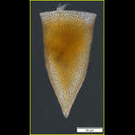 Cyttarocylis ampulla formerly known as Cyttarocylis casseis