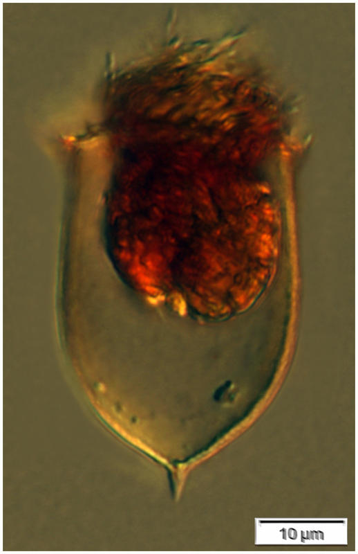 Acanthostomella norvegica