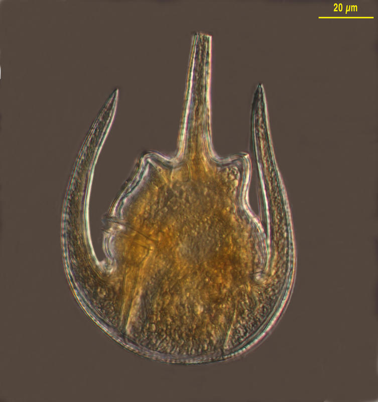 Ceratium limulus from Station 68 of the Tara Oceans Expedition