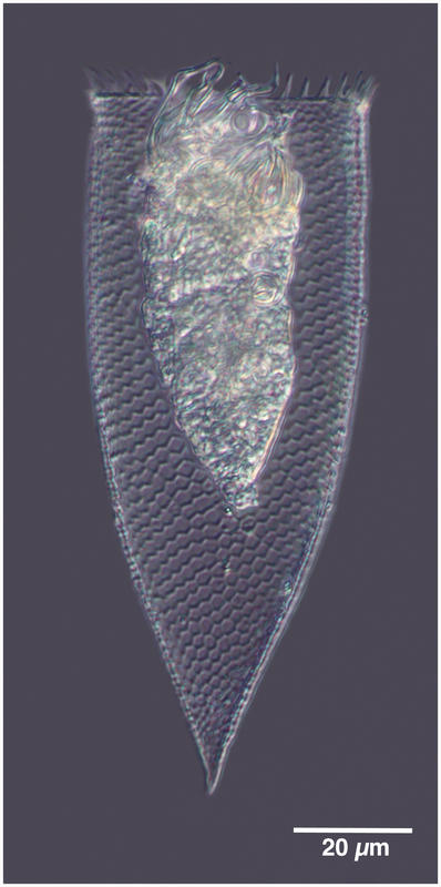 Parafavella parumdentata