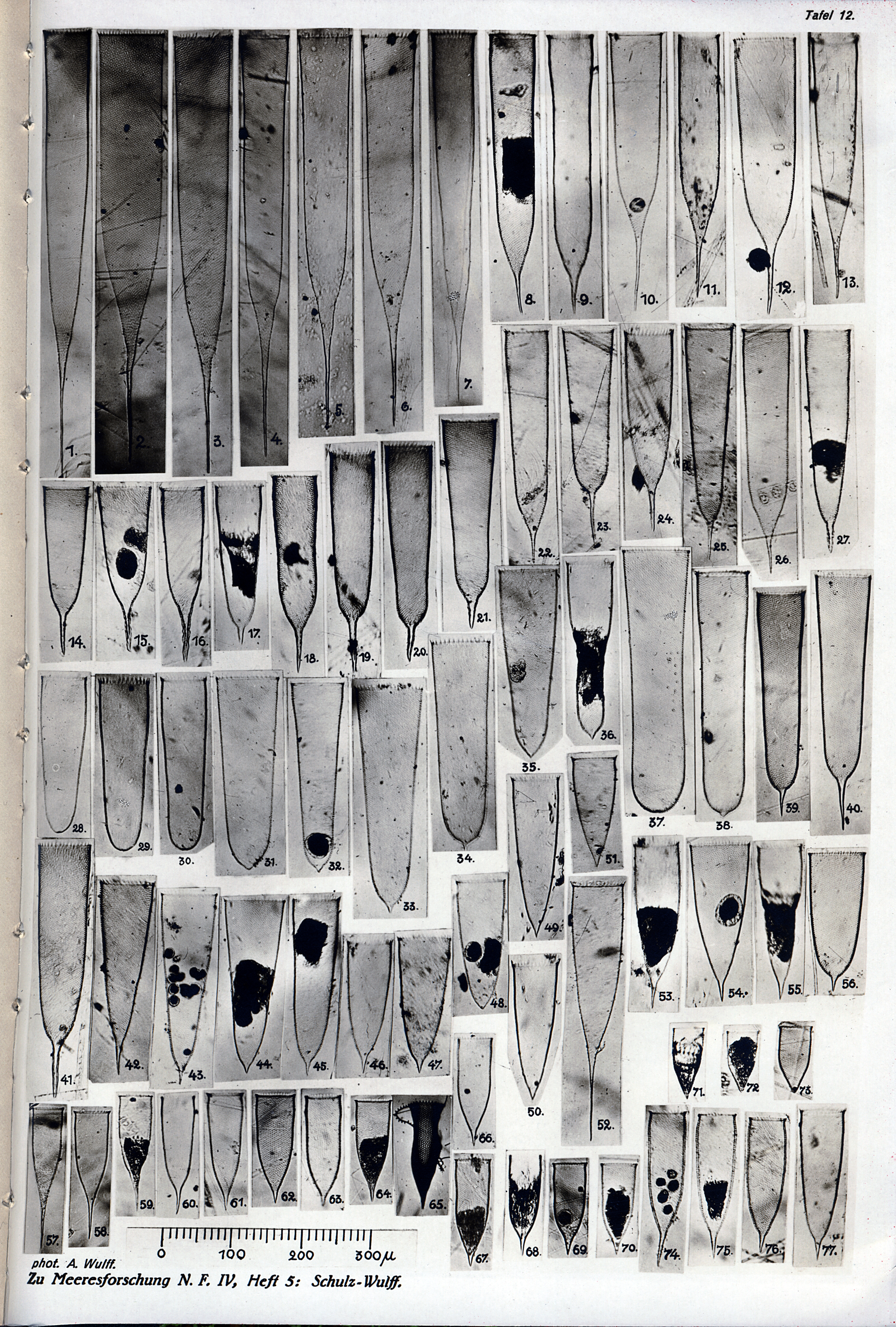 Parafavella Variabilty - Schulz & Wulff 1929