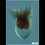 Acanthostomella novegica