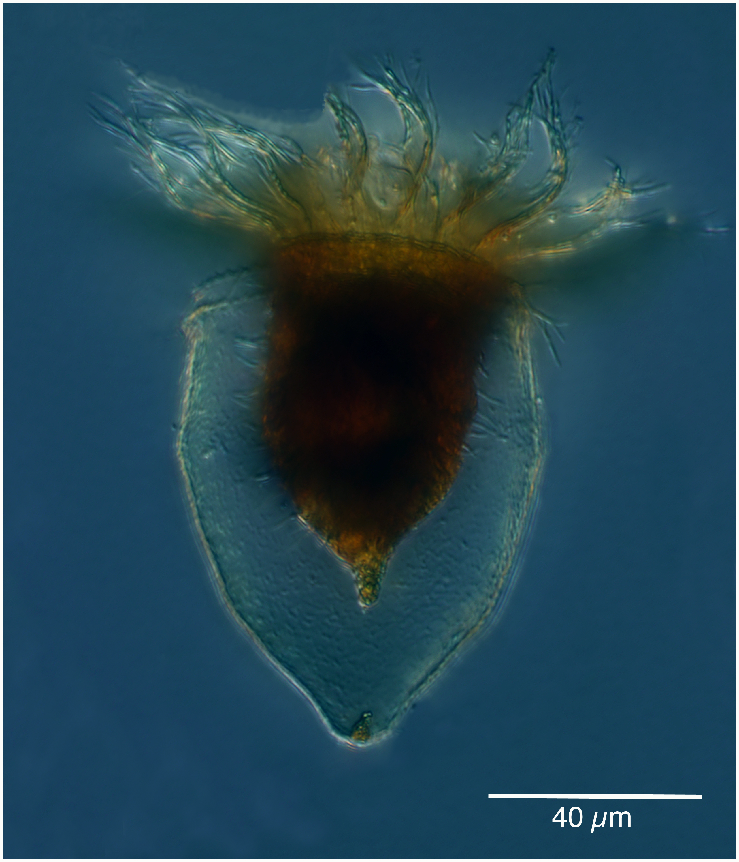 Ptychocylis obtusa from the Chukchi Sea