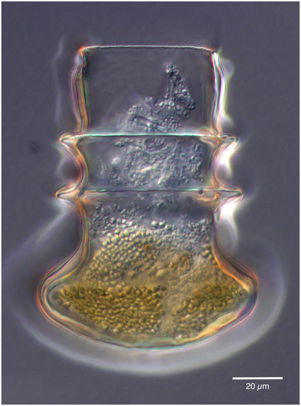 Amplectella collaria