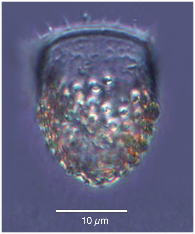Acanthostomella minitissima