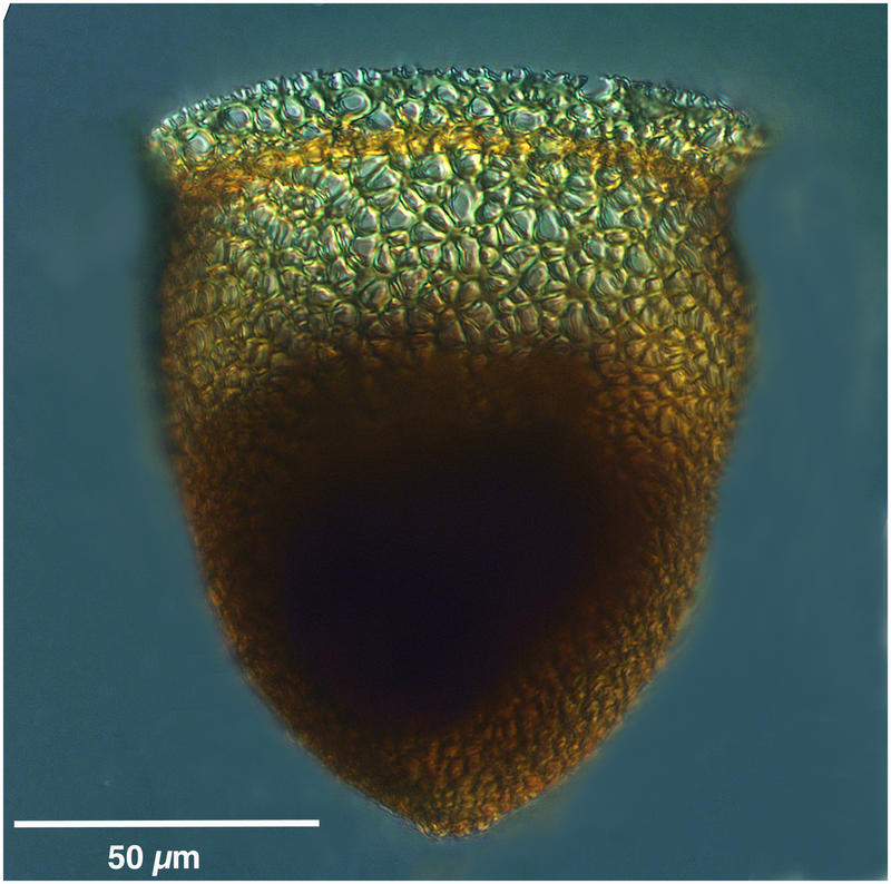 Cyttarocylis ampulla forma eucecryphalus