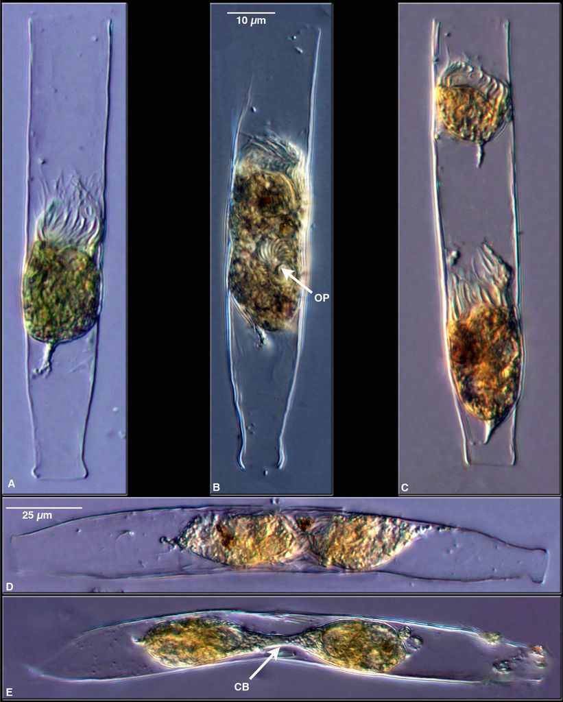 Life history stages of a tintinnid, Eutintinnus inquilinus