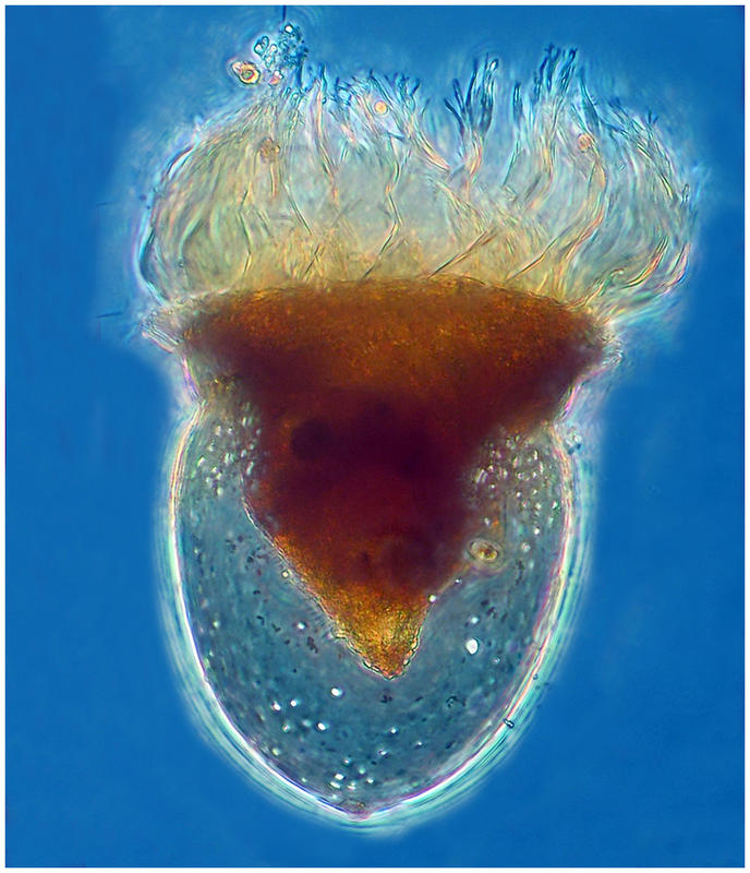 Petalotricha ampulla swimming!