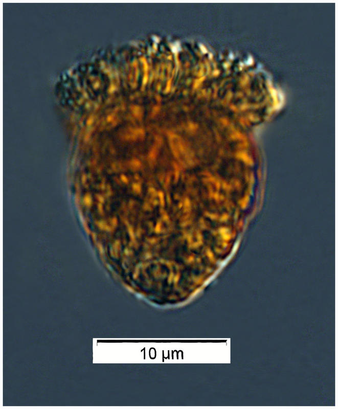 Nano Strobilid ciliate